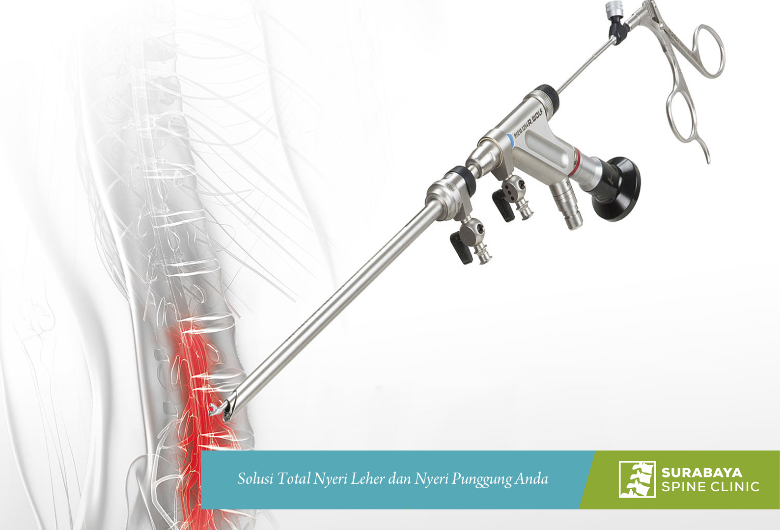 Microdiscectomy VS Endoscopic Discectomy Menurut Pendapat Kami